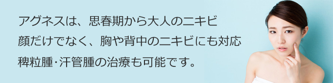 思春期や大人のにきび