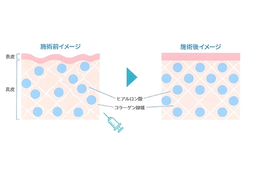 部位ごとに最適な製剤