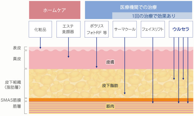 たるみ治療の比較