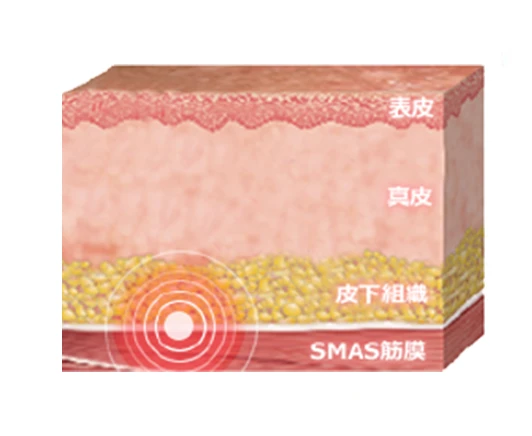 表皮→真皮→皮下組織→SMAS筋膜