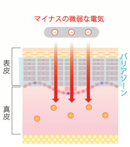 イオン導入の場合