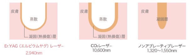 他治療との比較