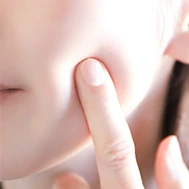 にきび改善