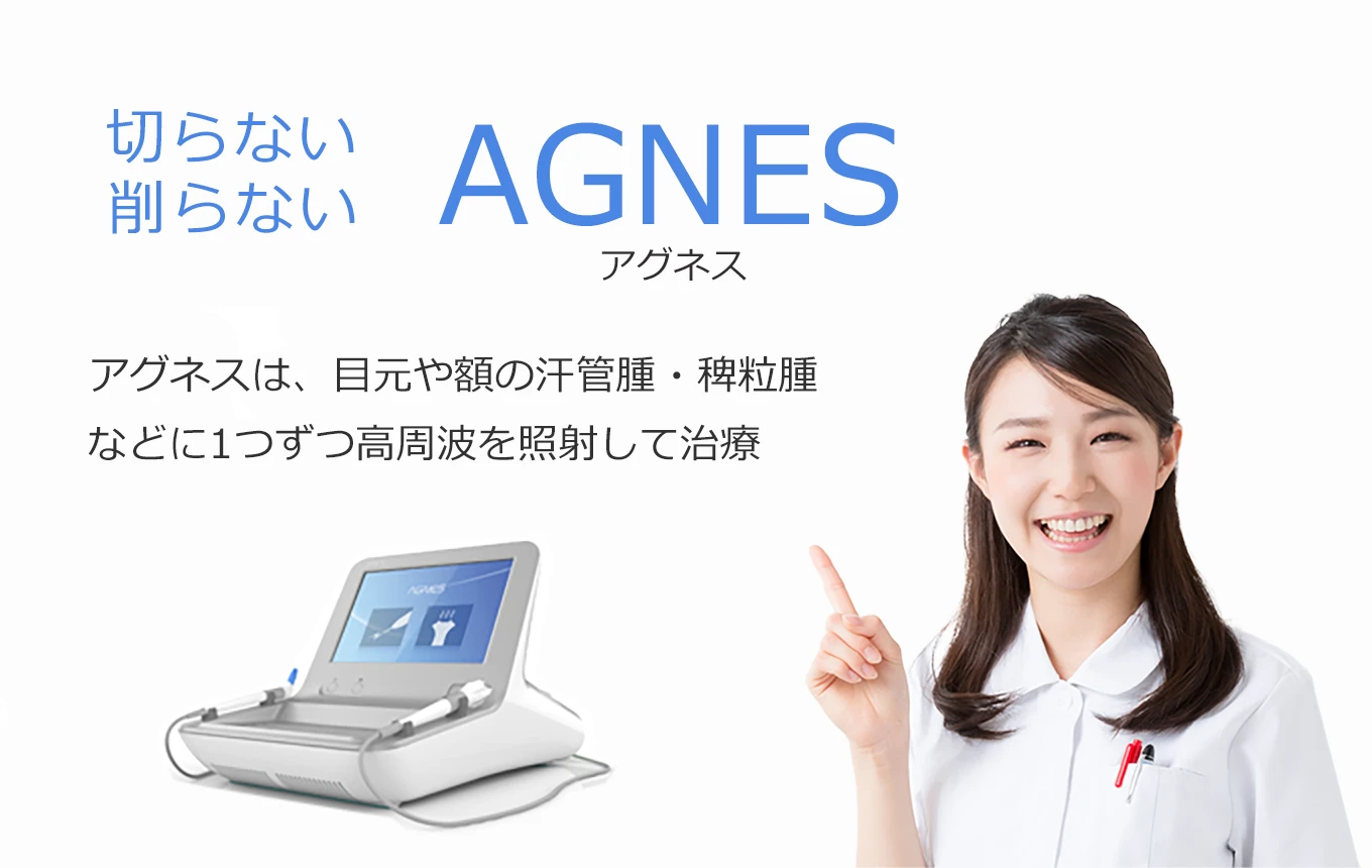 アグネスによる治療
