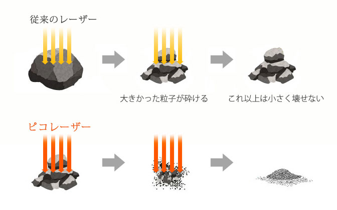 ピコレーザーでしみの除去