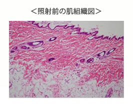 照射前の皮膚組織図