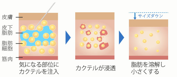 脂肪溶解注射の成分