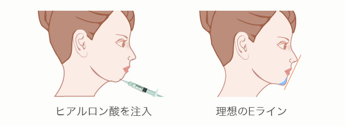 理想的なEライン