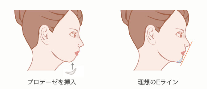 理想的なEライン