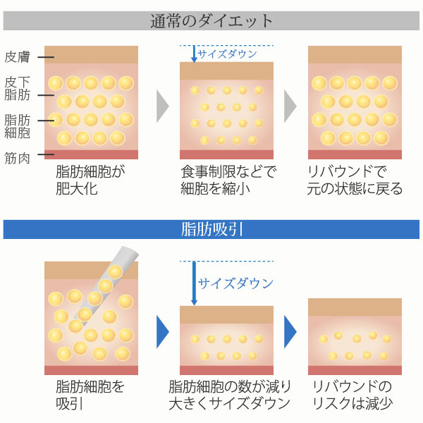 即効性のある小顔治療