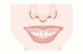 ガミースマイルの歯茎