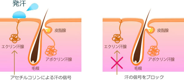 発汗抑制注射の仕組み